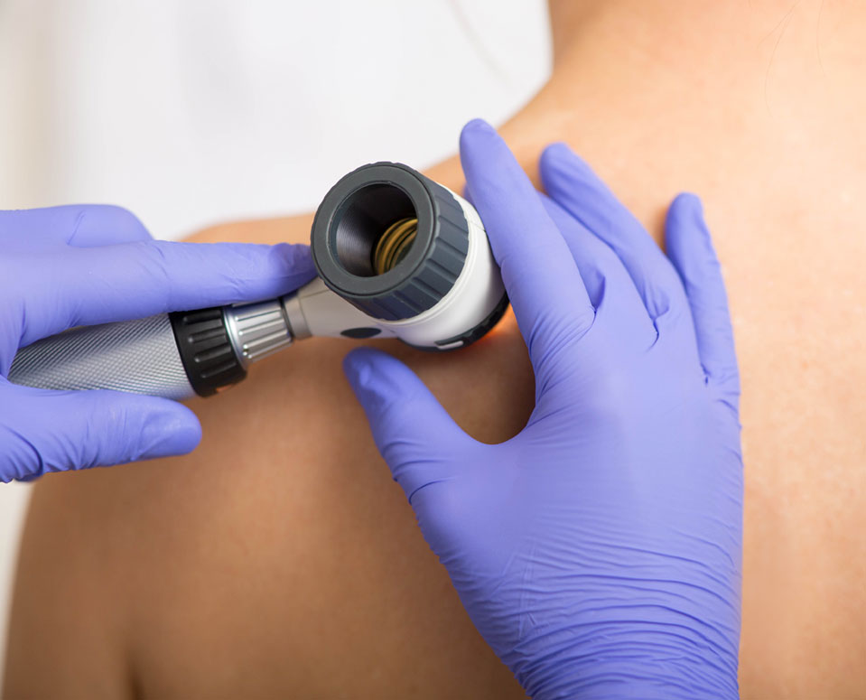 Dermatolog w Bytomiu