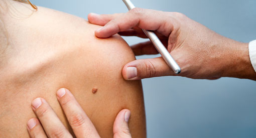 Poradnia dermatologiczna Bytom - Wszawica świerzb łupież