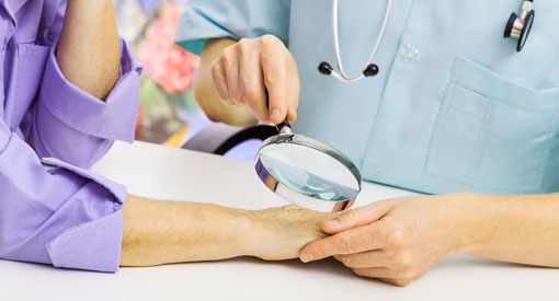 Poradnia dermatologiczna Bytom - Czerniak skóry