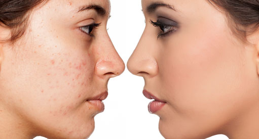 Poradnia dermatologiczna Bytom - Uczulenie słoneczne-fotodermatozy