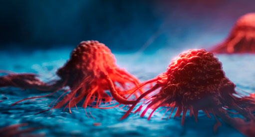 Poradnia onkologiczna Bytom - Biopsja