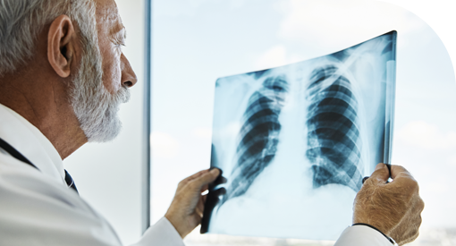 Poradnia Pulmonologiczna Bytom - Przewlekła obturacyjna choroba płuc